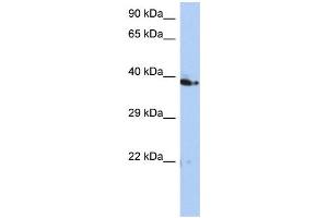 WB Suggested Anti-C10orf46 Antibody Titration: 0. (CACUL1 anticorps  (Middle Region))
