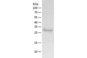 Western Blotting (WB) image for Cyclin-Dependent Kinase 16 (CDK16) (AA 158-496) protein (His-IF2DI Tag) (ABIN7122526)