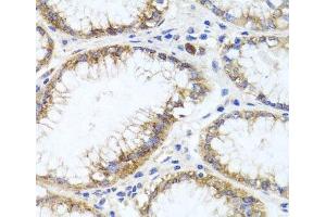 Immunohistochemistry of paraffin-embedded Human stomach using GPM6A Polyclonal Antibody at dilution of 1:100 (40x lens).