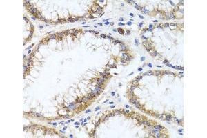 Immunohistochemistry of paraffin-embedded Human stomach using GPM6A Polyclonal Antibody at dilution of 1:100 (40x lens). (GPM6A anticorps)