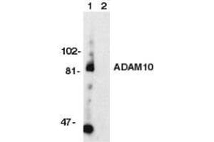 Western blot analysis of ADAM10 in Jurkat whole cell lysate with ADAM10 antibody at 1ug/ml Immunocytochemistry: use at 1-5ug/ml (ADAM10 anticorps)