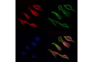 ABIN6257028 and ABIN6275977 staining Hela cells by IF/ICC. (CCZ1B anticorps)