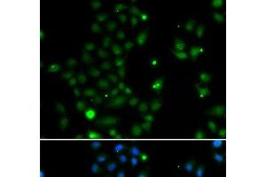 Immunofluorescence analysis of MCF-7 cells using GCM1 Polyclonal Antibody (GCM1 anticorps)