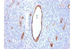 Formalin-fixed, paraffin-embedded human Tonsil stained with vWF Recombinant Mouse Monoclonal Antibody (rVWF/2480). (Recombinant VWF anticorps)