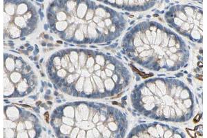 ABIN6278318 at 1/100 staining human colon    sections by IHC-P. (CD93 anticorps  (C-Term))