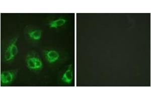 Immunofluorescence analysis of HeLa cells, using Calsenilin/KCNIP3 (Ab-63) Antibody. (DREAM anticorps  (AA 29-78))