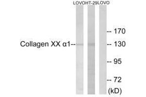 Western blot analysis of extracts from HUVEC cells, using Collagen XX α1 antibody. (COL2A1 anticorps  (C-Term))