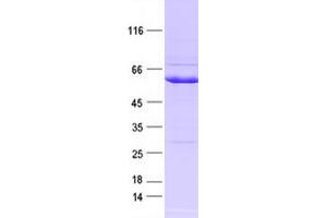 Validation with Western Blot