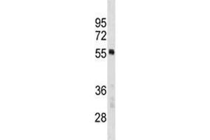 PTBP1 antibody western blot analysis in MCF-7 lysate.