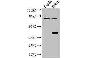 Western Blot Positive WB detected in: HepG2 whole cell lysate, Mouse brain tissue All lanes: FIGN antibody at 3 μg/mL Secondary Goat polyclonal to rabbit IgG at 1/50000 dilution Predicted band size: 83 kDa Observed band size: 83, 38 kDa (Fidgetin anticorps  (AA 132-371))
