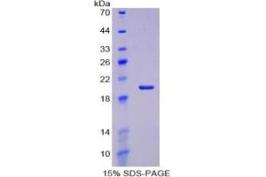 SDS-PAGE of Protein Standard from the Kit  (Highly purified E. (Aggrecan Kit ELISA)
