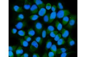 IF analysis of HSPA6 using anti-HSPA6 antibody (ABIN7601944). (HSPA6 anticorps  (AA 516-643))