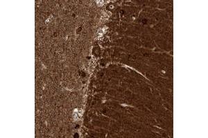 Immunohistochemical staining of human cerebellum with ZNF512 polyclonal antibody  shows strong cytoplasmic and nucleolar positivity in Purkinje cells. (ZNF512 anticorps)