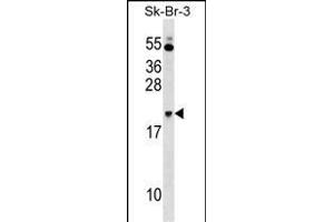 NKIRAS1 Antibody (Center) (ABIN1538446 and ABIN2849067) western blot analysis in SK-BR-3 cell line lysates (35 μg/lane). (NKIRAS1 anticorps  (AA 48-76))