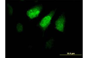 Immunofluorescence of purified MaxPab antibody to ZNF259 on HeLa cell.