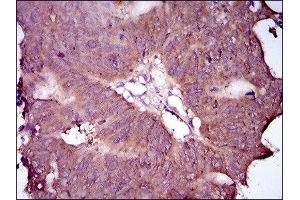 Immunohistochemistry (IHC) image for anti-EGFR Mutant (AA 693-893), (Mutant) antibody (ABIN1845729) (EGFR Mutant (AA 693-893), (Mutant) anticorps)