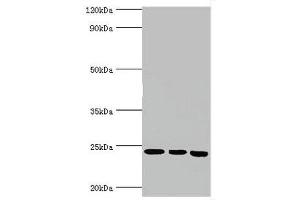 Western blot All lanes: BAG family molecular chaperone regulator 2 antibody at 6 μg/mL Lane 1: Jurkat whole cell lysate Lane 2: Hela whole cell lysate Lane 3: HepG2 whole cell lysate Secondary Goat polyclonal to rabbit IgG at 1/10000 dilution Predicted band size: 24, 21 kDa Observed band size: 24 kDa (BAG2 anticorps  (AA 1-211))