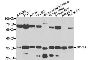 Western blot analysis of extracts of various cell lines, using STK19 antibody. (STK19 anticorps  (AA 75-364))