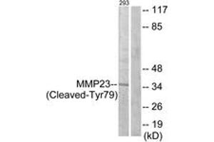 Western blot analysis of extracts from 293 cells, treated with etoposide 25uM 1h, using MMP23 (Cleaved-Tyr79) Antibody. (Matrix Metallopeptidase 23 (MMP23) (AA 60-109), (Cleaved-Tyr79) anticorps)