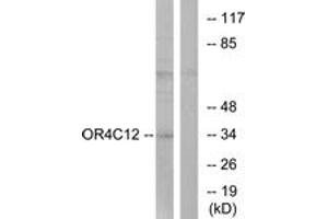Western blot analysis of extracts from Jurkat cells, using OR4C12 Antibody. (OR4C12 anticorps  (AA 260-309))