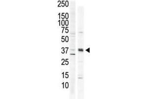 The anti-CAMK1 C-term Pab is used in Western blot to detect CAMK1 in HeLa cell lysate (lane 1) and primate brain tissue lysate (lane 2).