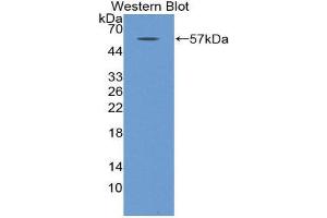 Western Blotting (WB) image for anti-Myosin Heavy Chain 2, Skeletal Muscle, Adult (MYH2) (AA 1238-1472) antibody (ABIN1859925) (MYH2 anticorps  (AA 1238-1472))
