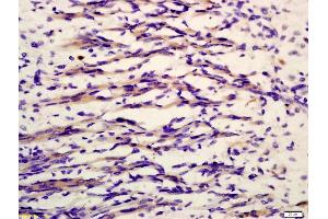 Formalin-fixed and paraffin embedded mouse embryonic muscle labeled with Anti-phospho-MYL9(Thr19) Polyclonal Antibody, Unconjugated (ABIN753238) at 1:200 followed by conjugation to the secondary antibody and DAB staining