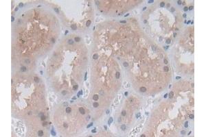 Detection of PSMb6 in Human Kidney Tissue using Polyclonal Antibody to Proteasome Subunit Beta Type 6 (PSMb6)