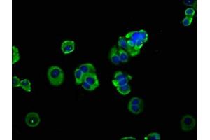 Immunofluorescence staining of MCF-7 cells with ABIN7150062 at 1:133, counter-stained with DAPI.