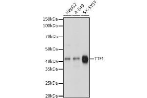 Western blot analysis of extracts of various cell lines, using TTF1 antibody (ABIN1679475, ABIN3017648, ABIN3017649 and ABIN7101514) at 1:1000 dilution.