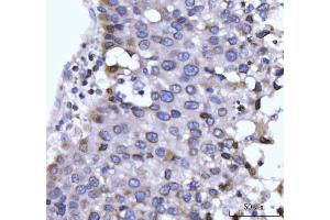 IHC analysis of GP210/NUP210 using anti-GP210/NUP210 antibody (ABIN7600707). (NUP210 anticorps  (AA 221-1724))