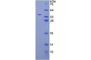 SDS-PAGE analysis of Human LMAN1 Protein. (LMAN1 Protéine)