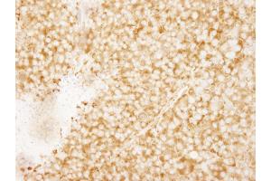 Immunohistochemistry (IHC) image for anti-RpL7a/SURF3 (C-Term) antibody (ABIN7449015) (RpL7a/SURF3 (C-Term) anticorps)