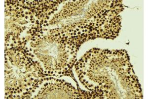 ABIN6276437 at 1/100 staining Mouse testis tissue by IHC-P. (BIRC2 anticorps  (C-Term))