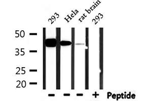 Western blot analysis of extracts from 293 and hela and rat brain, using USF2 Antibody. (USF2 anticorps  (Internal Region))
