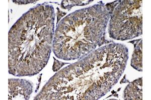 IHC analysis of PARK7 / DJ1 using anti-PARK7 / DJ1 antibody .