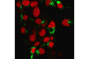 Immunofluorescence Analysis of human HePG2 cells labeling Albumin with Albumin Mouse Monoclonal Antibody (ALB/2355) followed by Goat anti-Mouse IgG-CF488 (Green). (Albumin anticorps)