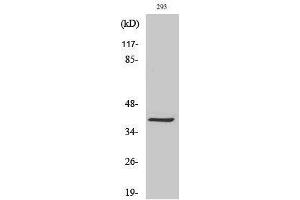 Western Blotting (WB) image for anti-Melanoma Antigen Family C, 2 (MAGEC2) (Internal Region) antibody (ABIN3185441) (MAGEC2 anticorps  (Internal Region))