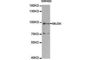 Western Blotting (WB) image for anti-Muscle, Skeletal, Receptor Tyrosine Kinase (MUSK) antibody (ABIN1873783) (MUSK anticorps)