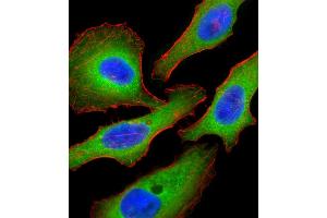 Fluorescent confocal image of Hela cell stained with Tuberin (TSC2) Antibody  (ABIN390324 and ABIN2840755). (Tuberin anticorps  (AA 1776-1805))