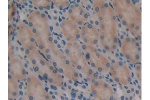 Detection of Flt3 in Mouse Kidney Tissue using Polyclonal Antibody to FMS Like Tyrosine Kinase 3 (Flt3)