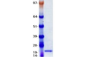 Validation with Western Blot