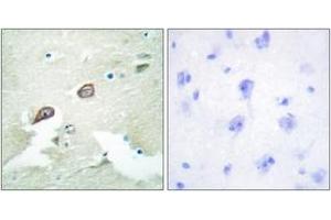 Immunohistochemistry analysis of paraffin-embedded human brain tissue, using HER3 (Ab-1222) Antibody. (ERBB3 anticorps  (AA 1191-1240))