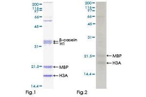 Western Blotting (WB) image for TP53 Regulating Kinase (TP53RK) (AA 1-253) protein (GST tag) (ABIN1323390)