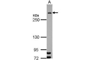 WB Image Sample (30 ug of whole cell lysate) A: HeLa nucleus 5% SDS PAGE antibody diluted at 1:1000