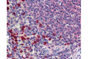 Anti-CLEC2D antibody IHC of human spleen.