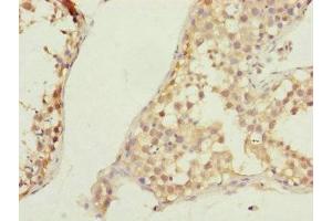Immunohistochemistry of paraffin-embedded human testis tissue using ABIN7147449 at dilution of 1:100 (CSPP1 anticorps  (AA 997-1256))