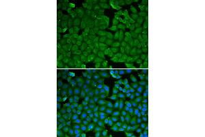 Immunofluorescence analysis of HeLa cell using SPINK1 antibody. (SPINK1 anticorps)