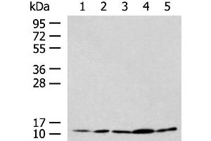 Western blot analysis of HL-60 Hela Jurkat LNCAP HepG2 cell lysates using PAM16 Polyclonal Antibody at dilution of 1:900 (MAGMAS anticorps)