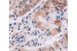 IHC-P analysis of Human Tissue, with DAB staining. (Periostin anticorps  (AA 500-630))
